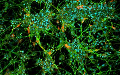 CQ1 Confocal Imaging Cytometer Anwendungen Neurology